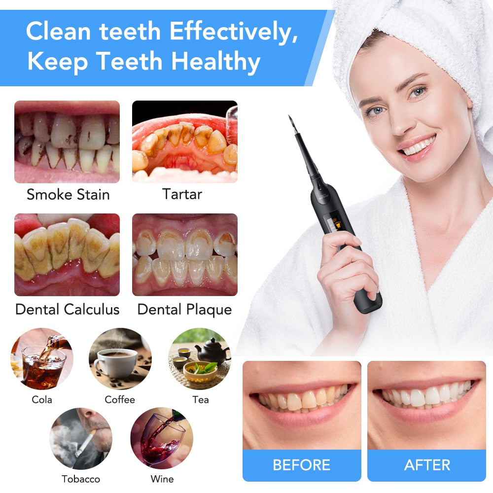 Electric Teeth Cleaner, Whitener & Plaque Remover