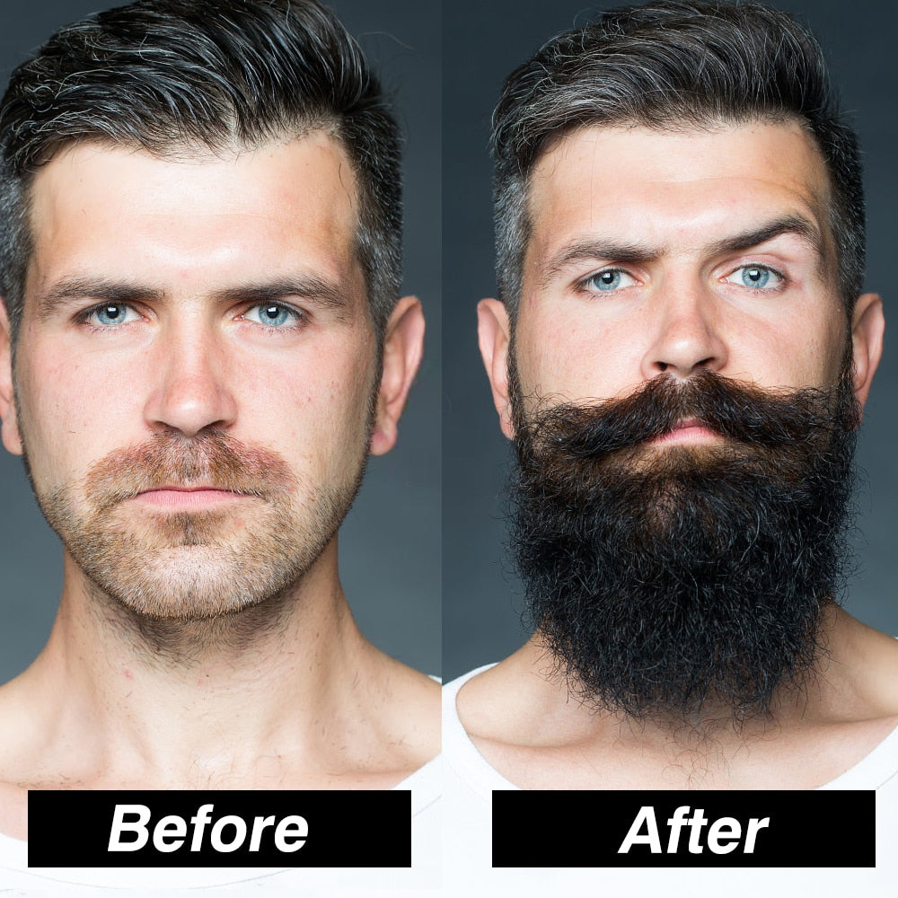 Beard Growth Enhancer Kit